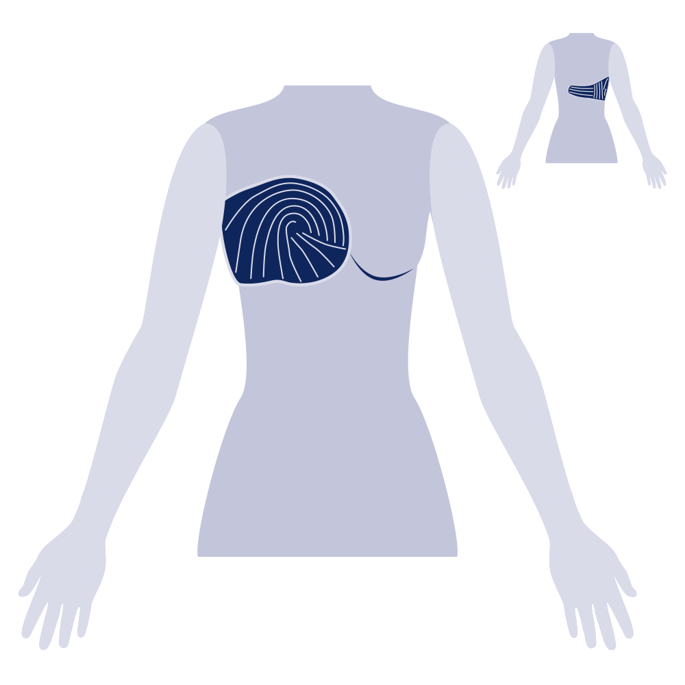 Post Lumpectomy Pad